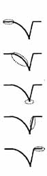 Voltage waveforms